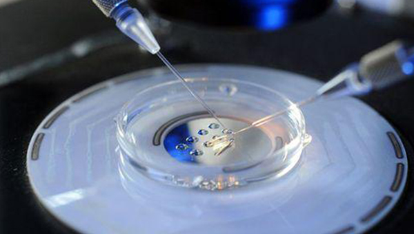 多囊卵巢综合征